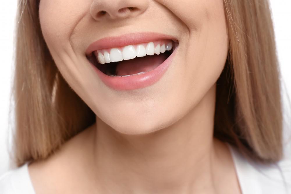 Are Veneers the Best Option for My Gapped Teeth?