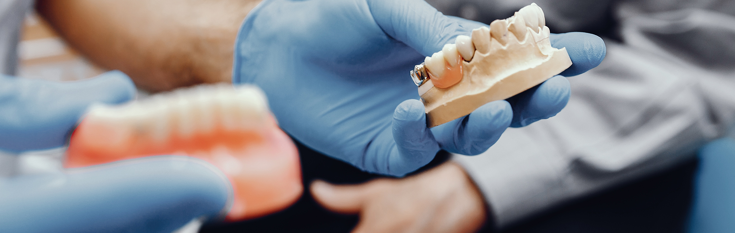 Full and Partial Dentures - Nobel Dentistry